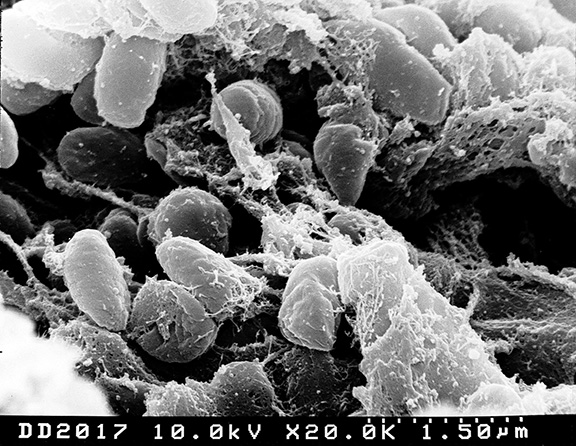 microbes under a microscope